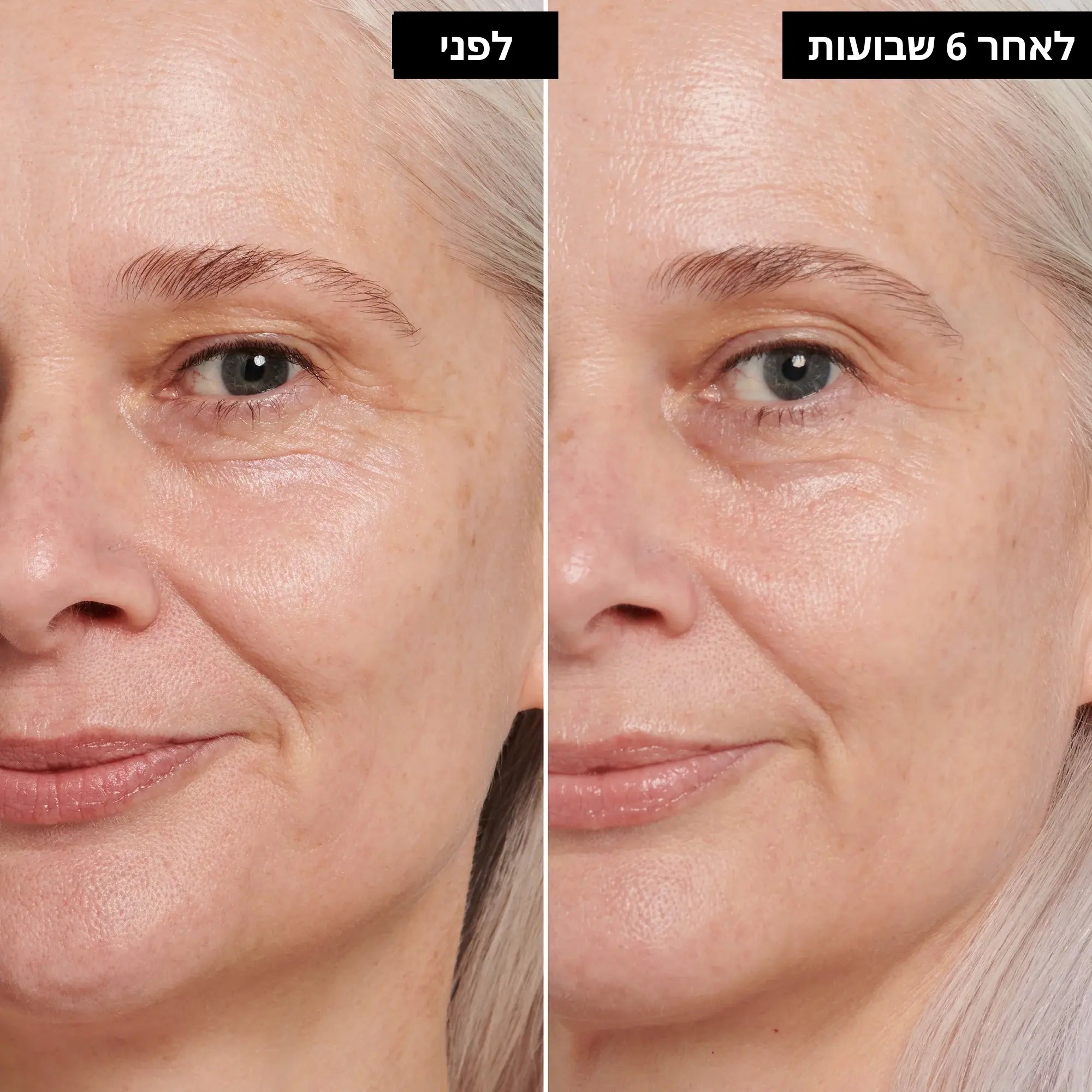 קרם עיניים רטינול.